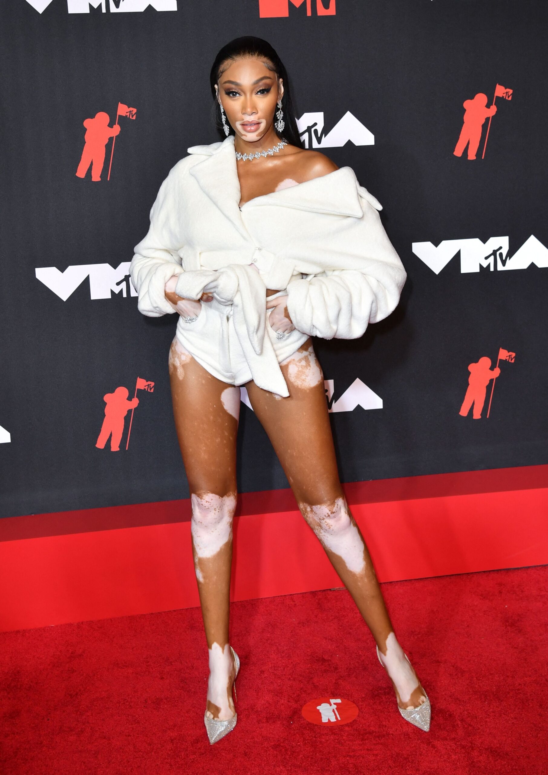 Winnie Harlow